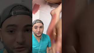 Depilación con cera en piernas (reacción) #hair #shorts #beauty #hairstyle #skincare