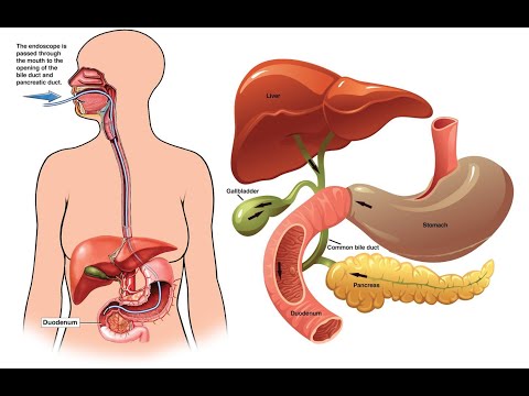 Cpt For Ercp