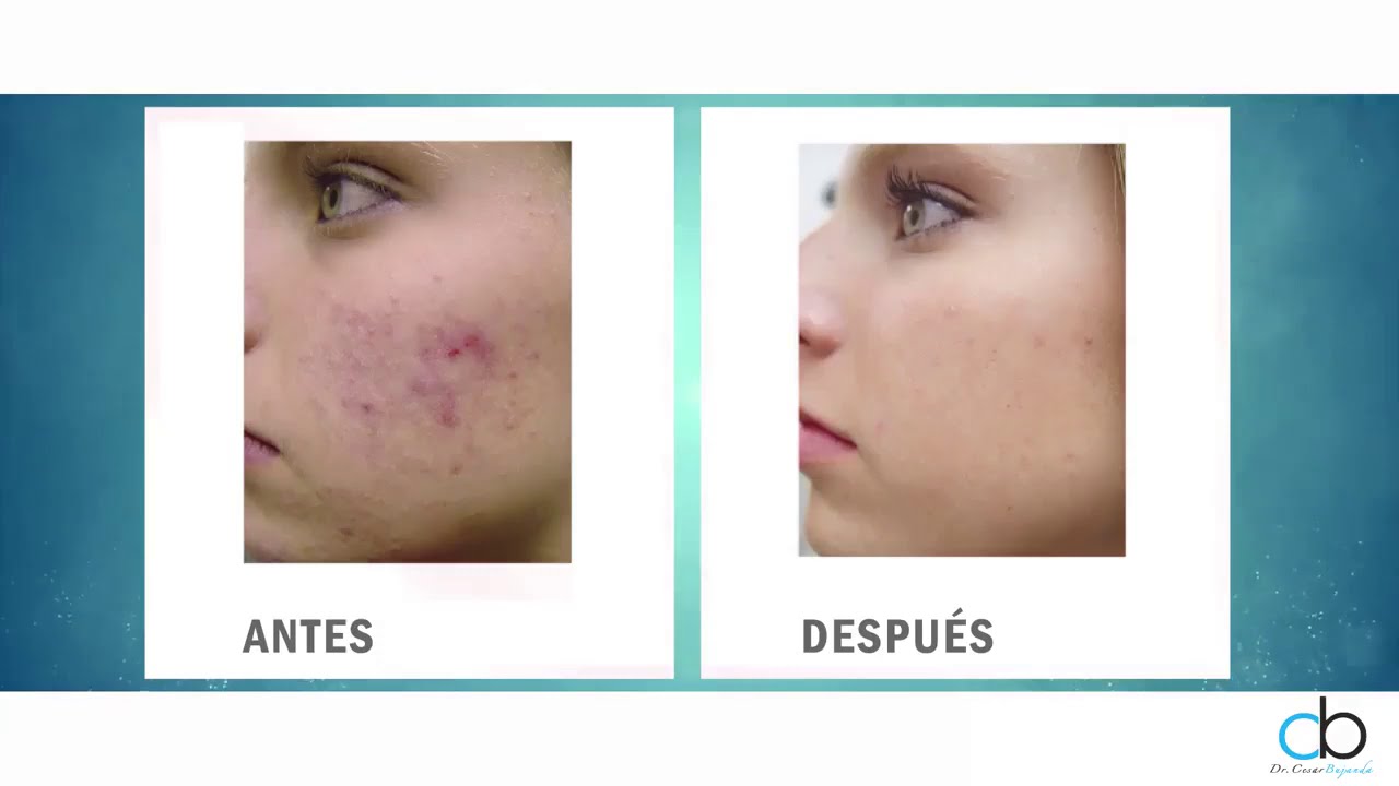 César Noé Bujanda Mena-28