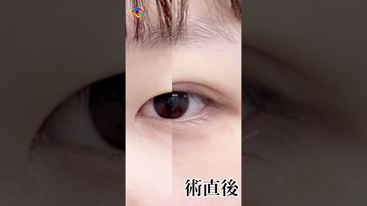 Youtubeのサムネイル