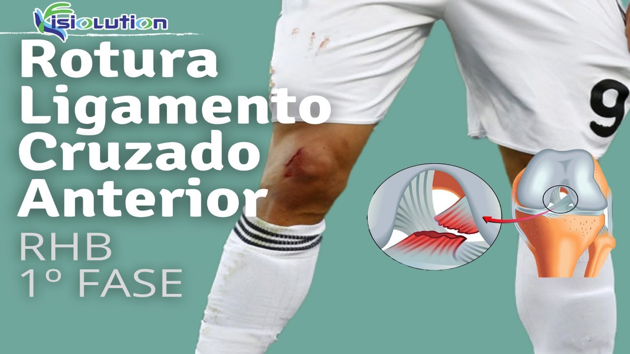 Watch Ligamento Cruzado Anterior - REHABILITACIÓN con EJERCICIOS - 1º FASE | Fisiolution Now Ligamento Cruzado Anterior - REHABILITACIÓN con EJERCICIOS - 1º FASE | Fisiolution