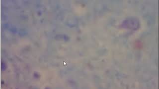 SNC coloreado con Klüver Barrera