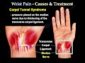 wrist pain,causes and treatment PART I. Everything ...