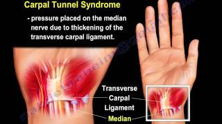 wrist pain,causes and treatment  PART I. Everything You Need To Know - Dr. Nabil Ebraheim