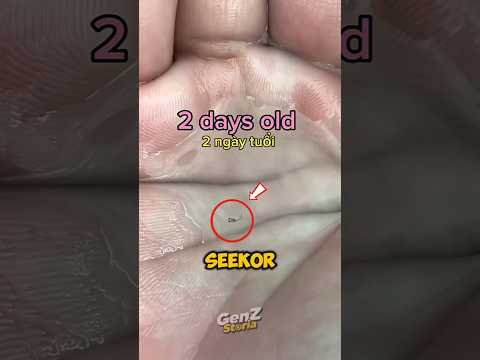 Timelapse makhluk kecil yang mungil 😱‼️