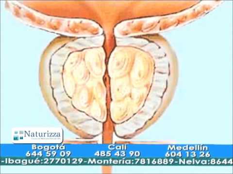 Mal di schiena da prostatite Se PROSTATA massaggio