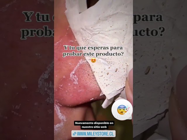 Vídeo relacionado con LANBENA Puntos Negros, Pore Strips, Deep Cleansing for Face, Nose, Black Head Remover, 10-15 Minutes Leaving Your Skin Fresh and Clean