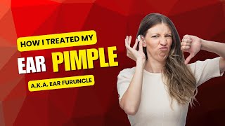 I Got an Ear Pimple and It Was Unbearably Painful—Here's What Happened