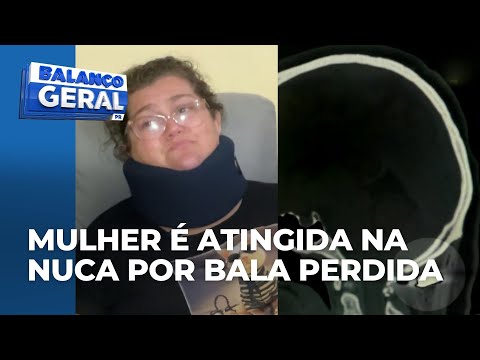 Vítima de bala perdida em Colombo recebe alta e fala ao vivo com o BG; suspeito é procurado