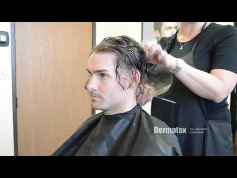 Men's Hair Restoration San Diego Orange County