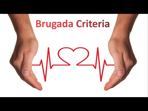Brugada Criteria for VT vs SVT I ECG Made Super Easy