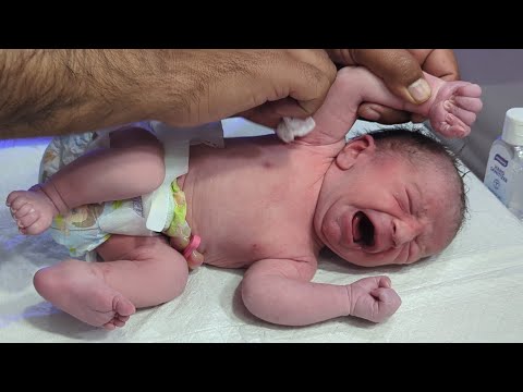 Expected Normal Findings vs Abnormal Findings Explained ❤️😻 #assessment #nicu #nicubaby 