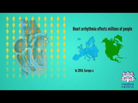 Heart Arrhythmia, Causes, Signs and Symptoms, Diagnosis and Treatment.