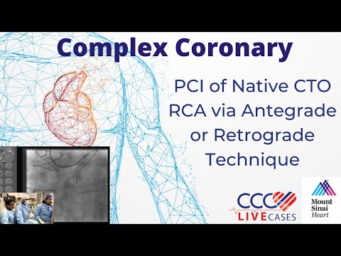 PCI of Native CTO RCA via Antegrade or Retrograde Technique - February 21, 2012 Webcast Video