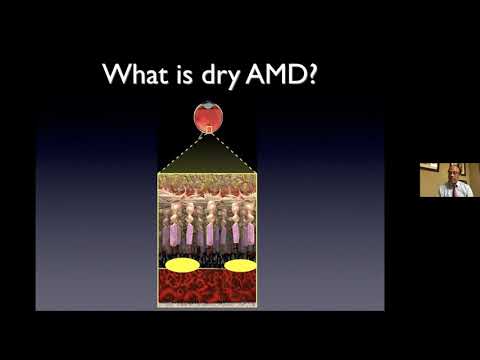 Basics of Macular Degeneration  Dry vs Wet