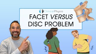 What are the Differences Between a Disc Problem and a Facet Problem? | Expert Physio Review