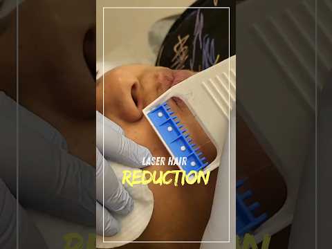 Laser Hair Reduction 