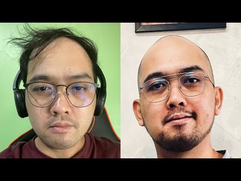 The LIFE and DEATH Of My COMBOVER