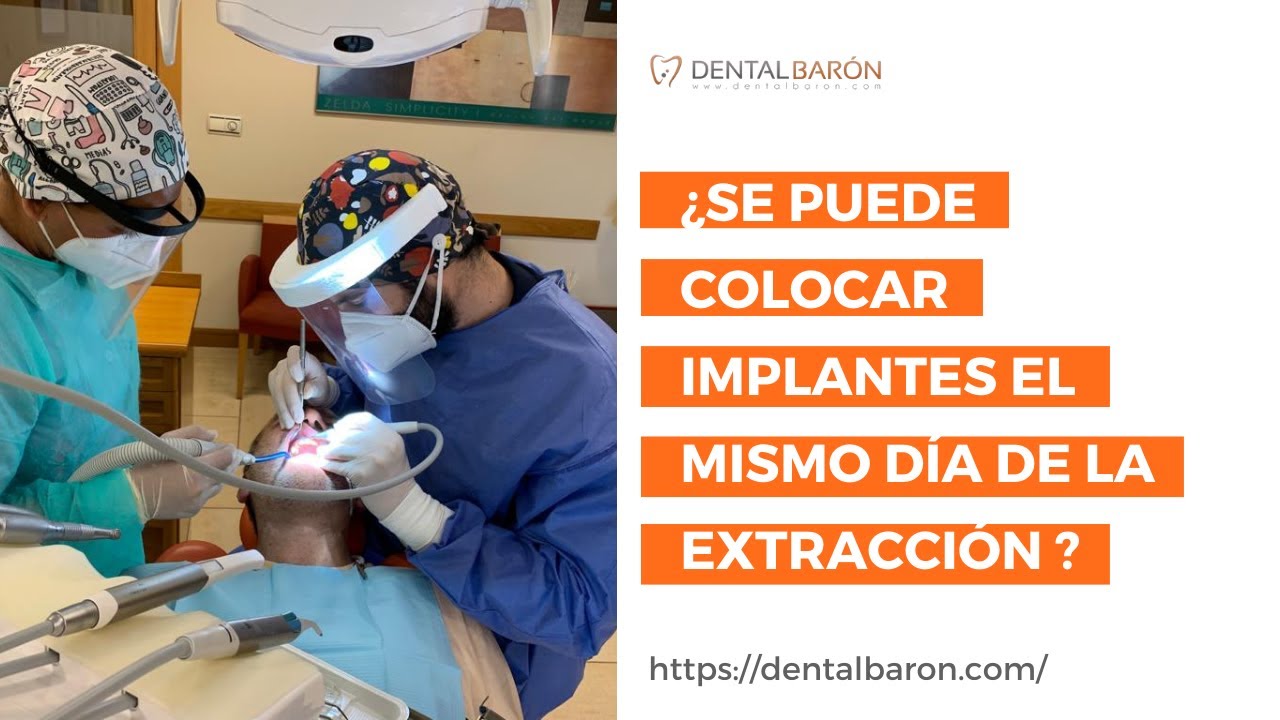 ¿Se puede colocar implantes luego de una extracción dental