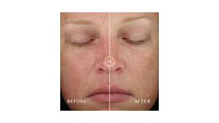 CARE Plastic Surgery | DG_Before-After-03