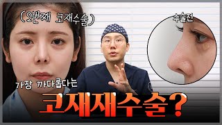 가장 까다롭다는 코재재수술?