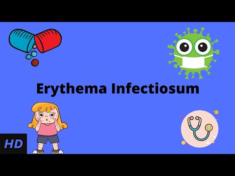 Sunburn Causes Signs and Symptoms Diagnosis and Treatment