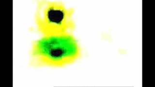 Orb Pics Enhanced With Special Effects Dream Music