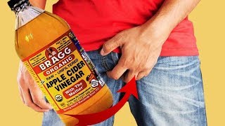 How to Treat Jock Itch with Apple Cider Vinegar FAST NATURALLY