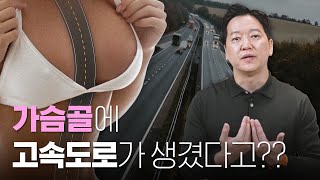 I골, Y골, 고속도로? 가슴골 수술비법 대.공.개!!