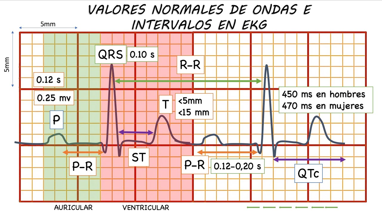 ELECTROCARDIOGRAMA NORMAL. GUÍA DEFINITIVA!!!