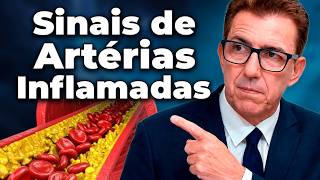 Disfunção Erétil Pode Ser Sinal de Artérias Inflamadas | Dr. Alain Dutra - Fernando Beteti