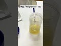 Hcg Pregnancy Test Shorts