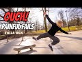 Broken Bones PAINFUL FAILS Fails Of The Week