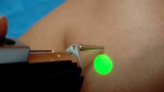 DEPILACION LASER.MPG