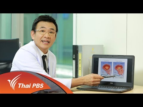 ไม่มีเรี่ยวแรงใน 18 ปี วิธีที่จะทำให้ค้อนของ ธ อร์