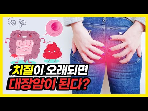 혈변이 보이면 대장암 의심해야 할까? (변비 예방 팁까지!)