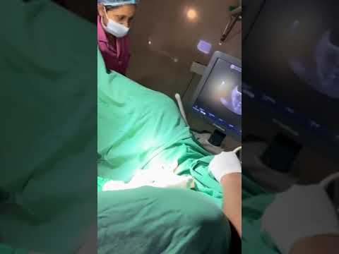 It always seems impossible until it’s done! A successful IVF treatment is done by Dr. Gunjan Gupta