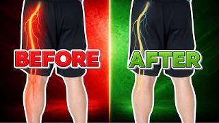 5 Best Sciatica Secrets for Immediate Relief!