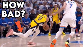 Tyrese Haliburton Calf Injury Is Concerning! Doctor Explains