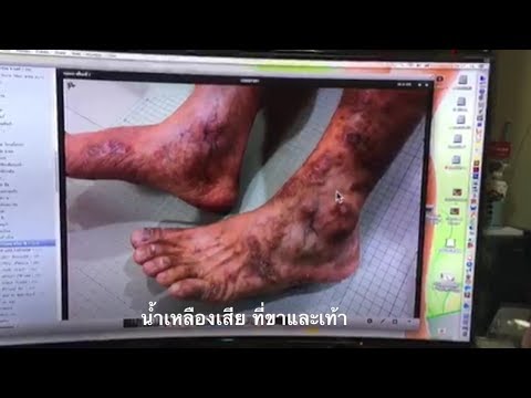 เชื้อโรคหญิงทำงานได้ดีขึ้น วิตามินแรง