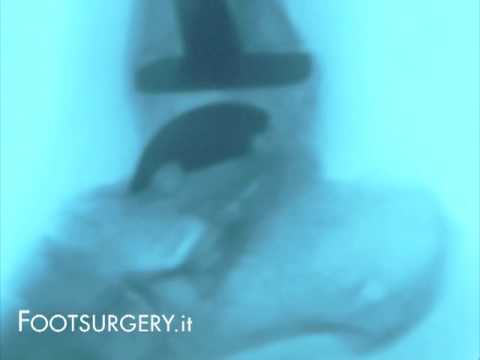 Ð ± оР»Noe D² Ð³Ð¾Ñ € л Ð df ÑƒÑ ... df Ð¿Ñ € Ð Ñ Ñ, ÐμÐ¾Ñ ... онÐÑ € оР· Storia medica con osteocondrosi della colonna cervicale