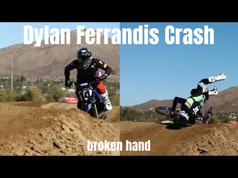 Crash from Dylan Ferrandis yesterday practicing // Broken Hand 😬