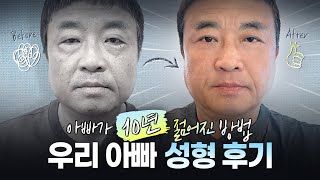 우리 아빠 10년 젊어진 방법ㅣ상안검+하안검+눈밑지 후기