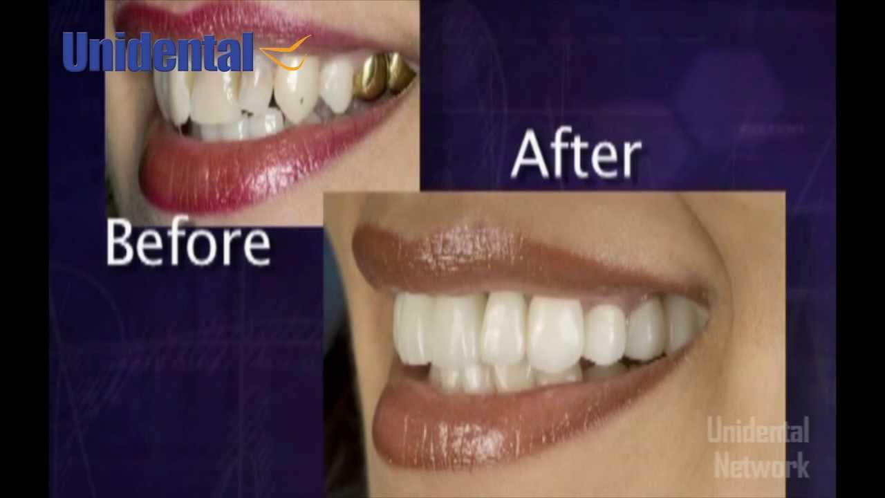 Alejandro Peña Vega-20