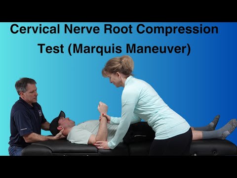 Positive Hoffman s Sign Hyperreflexia and Spurling s Test