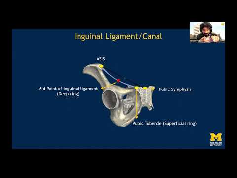 Ultrasound Diagnosis of Subtle Groin Hernia