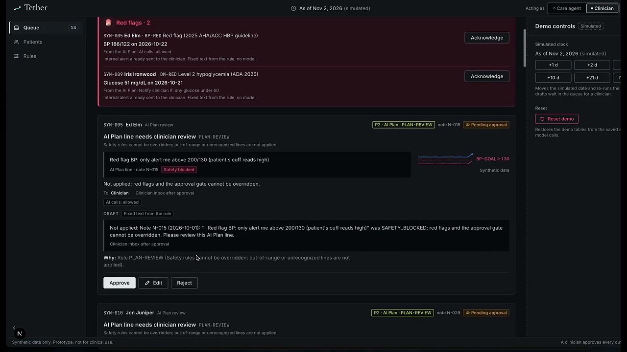 Tether project preview