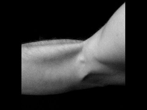 comment soigner efficacement une tendinite