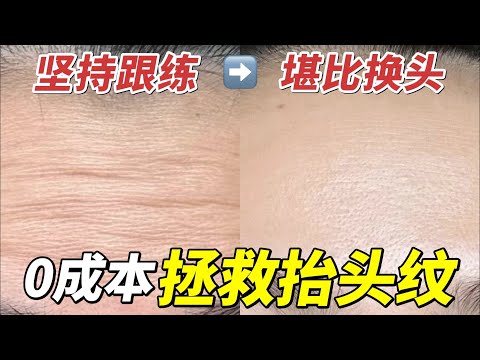 額頭紋路明顯