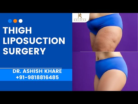 Thigh Liposuction Surgery Gurgaon